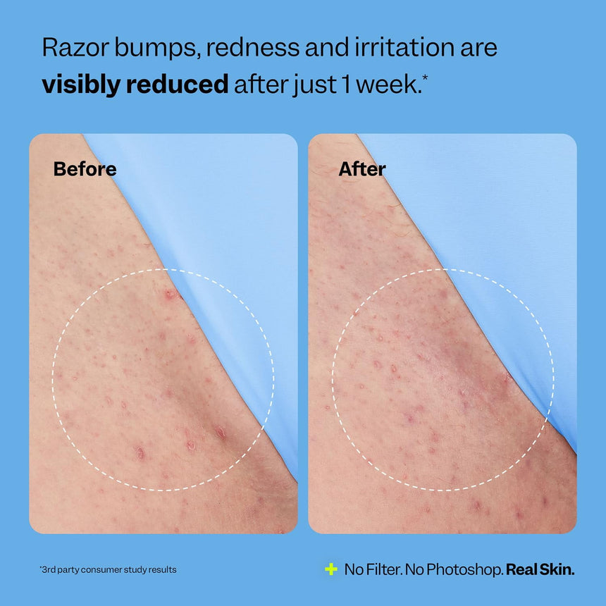 Solución Suavizante para Vellos Encarnados Peach Slice Smoothing Solution