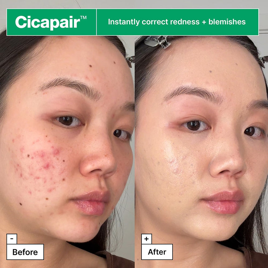 Tratamiento Corrector de Rojeces Cicapair Soothing Color Correcting Treatment Spf30 5ml