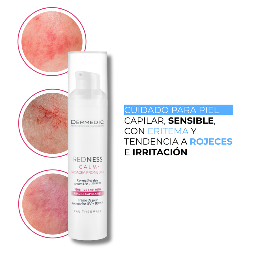 Crema con Protector Solar para Piel Sensible Dermedic Redness Calm Rosacea Prone Skin 40ml