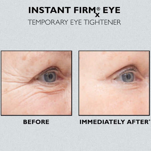 Tensor de Ojos Peter Thomas Roth Instant Firmx Eye Temporary Tightener