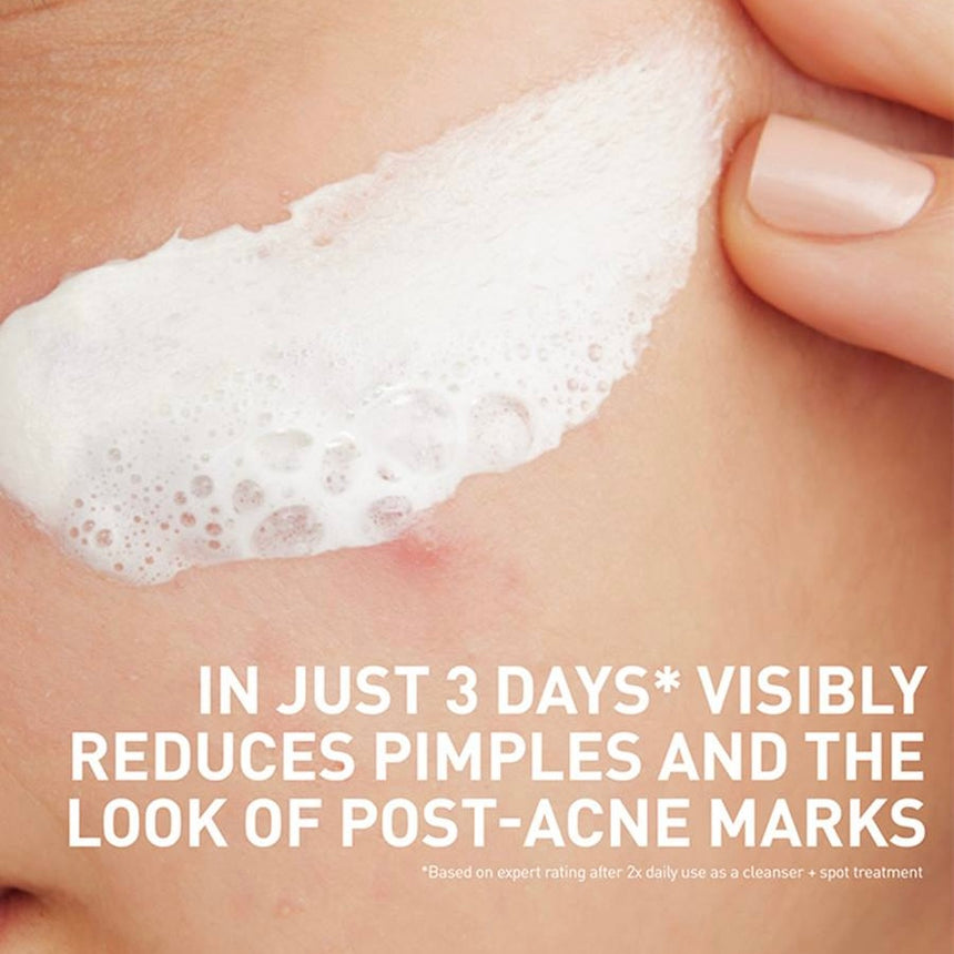 Limpiador Facial para Acné Cerave Acne Clay To Foam Cleanser 118ml