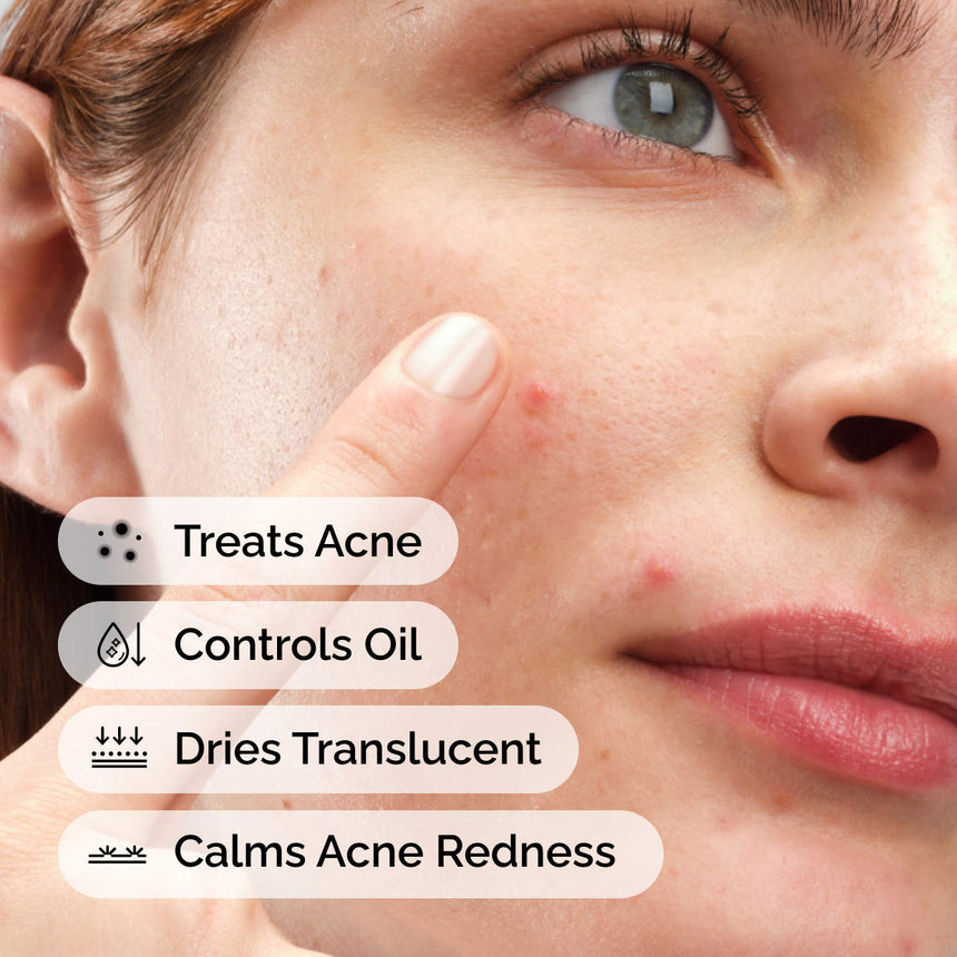 Crema en Polvo The Ordinary Sulfur 10% Powder to Cream Concentrate Acne Spot Treatment 5g