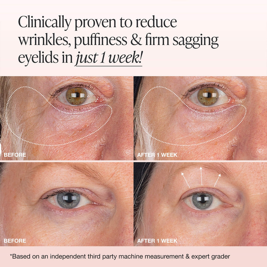 Crema Reafirmante de Ojos Innbeauty Project Mini Extreme Cream Eye Firming & Contouring