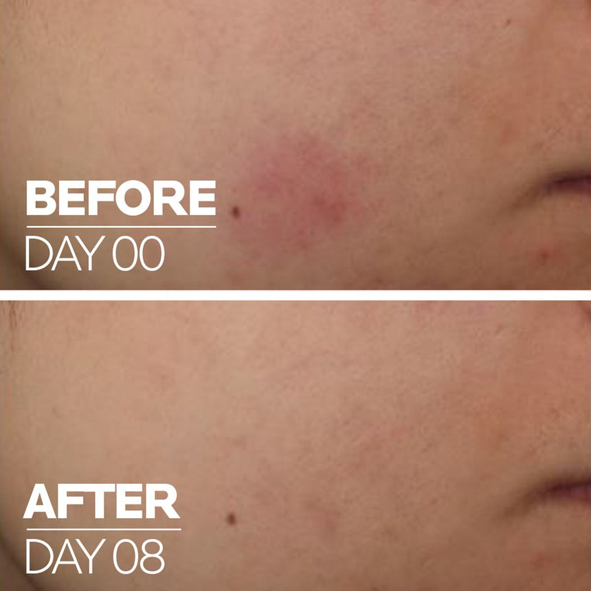 Serum Reparador e Hidratante La Roche Posay Cicaplast B5 Serum 30ml