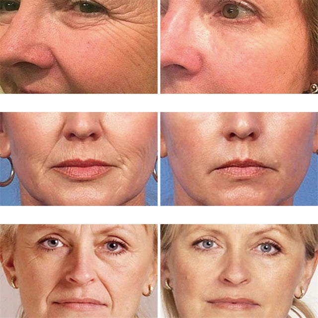 Serum Antioxidante para Líneas de Expresión Bioaqua Camellias Anti Oxidation Nourishing Essence