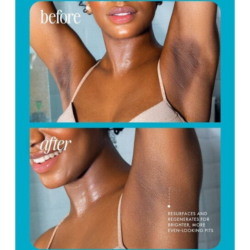 Al por Mayor Serum para Manchas de Axila Truly Jelly Booster Pigment Treatment Body Potion