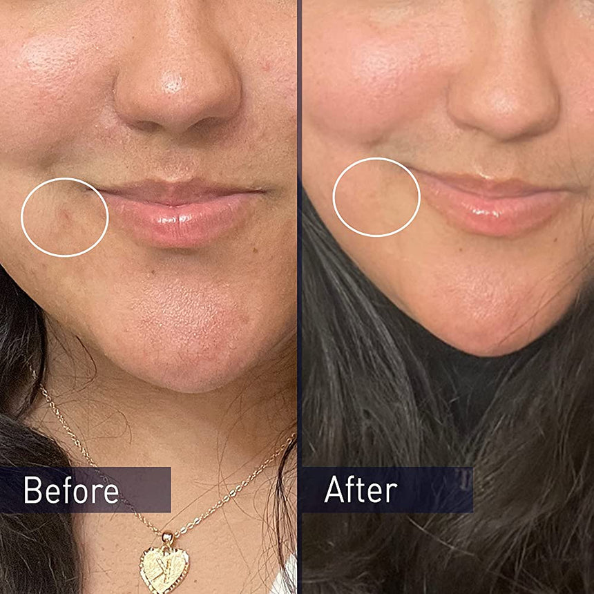 Al por Mayor Limpiador para Acné PanOxyl Acne Foaming Wash 156g