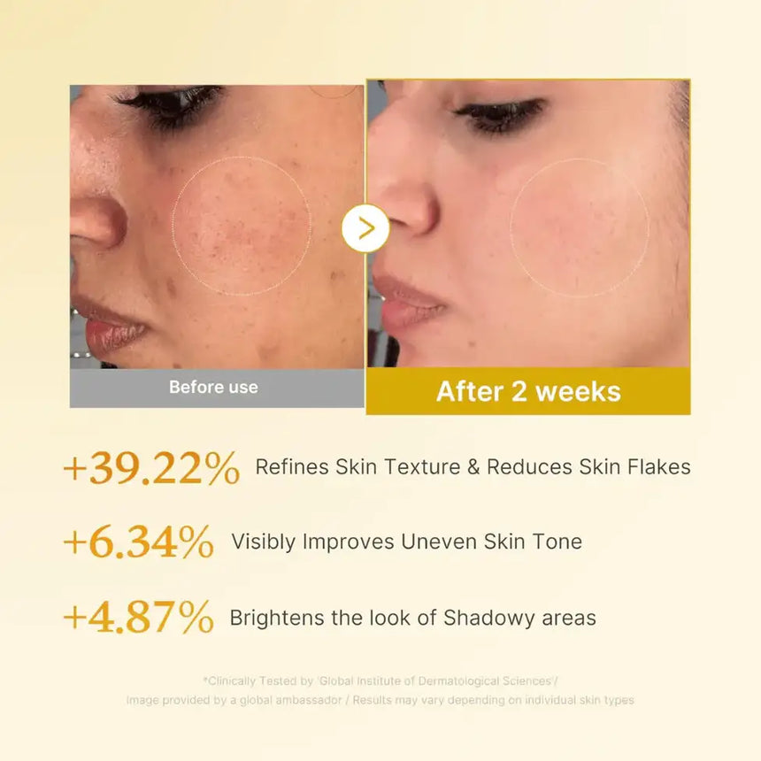 Tónico de Ácido Kojic Medicube Kojic Acid Turmeric Resurfacing Toner 250ml