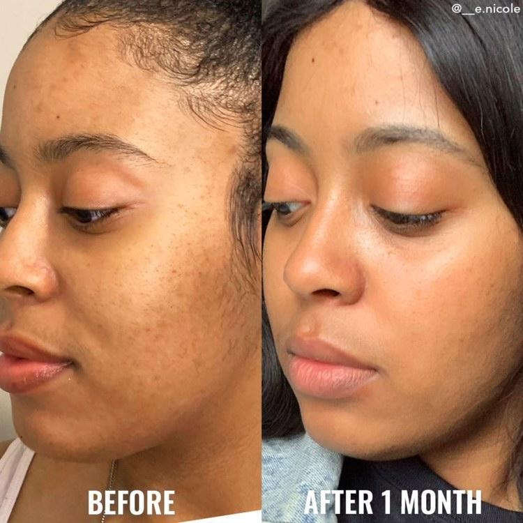 Exfoliante Good Molecules Glycolic Toner